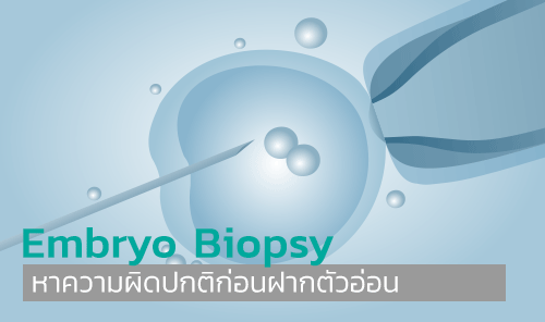 • หาความผิดปกติก่อนฝากตัวอ่อน กับเทคนิค Embryo Biopsy