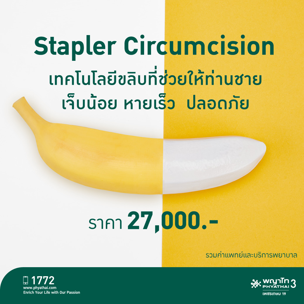 stapler circumcision ขลิบอวัยวะ