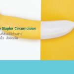 ข้อดีของการขลิบ Stapler Circumcision