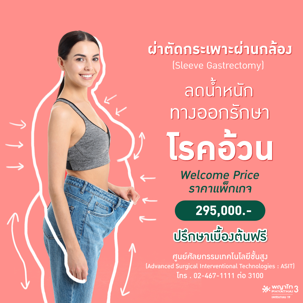 ผ่าตัดกระเพาะเพื่อลดน้ำหนัก (Bariatric Surgery) ผ่านกล้อง ช่องทางผอมของคนป่วยเป็นโรคอ้วน!!